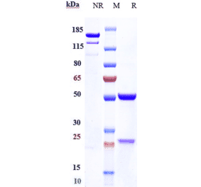 SDS-PAGE - Anti-Haptoglobin Antibody [Research Grade Biosimilar] - Low endotoxin, Azide free (A324050) - Antibodies.com