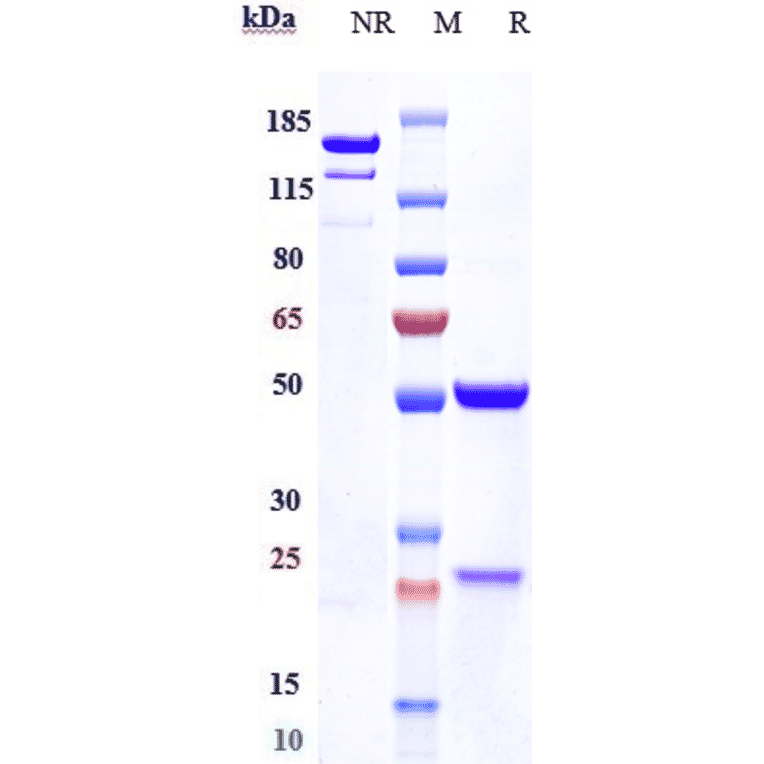 SDS-PAGE - Anti-Haptoglobin Antibody [Research Grade Biosimilar] - Low endotoxin, Azide free (A324050) - Antibodies.com