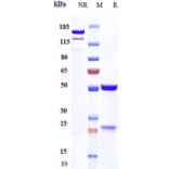 SDS-PAGE - Anti-Haptoglobin Antibody [Research Grade Biosimilar] - Low endotoxin, Azide free (A324050) - Antibodies.com