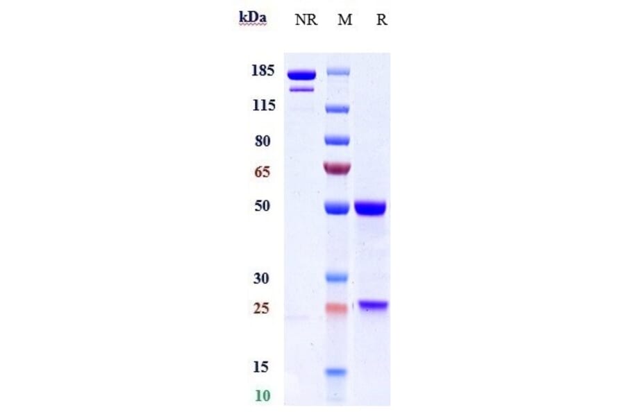 SDS-PAGE - Anti-HBEGF/DTR Antibody [KHK2866] - Low endotoxin, Azide free (A324052) - Antibodies.com