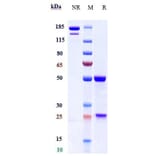 SDS-PAGE - Anti-HBEGF/DTR Antibody [KHK2866] - Low endotoxin, Azide free (A324052) - Antibodies.com