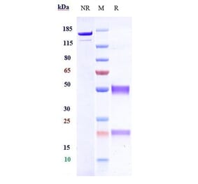 SDS-PAGE - Anti-Hemojuvelin Antibody [DISC-0974] - Low endotoxin, Azide free (A324053) - Antibodies.com