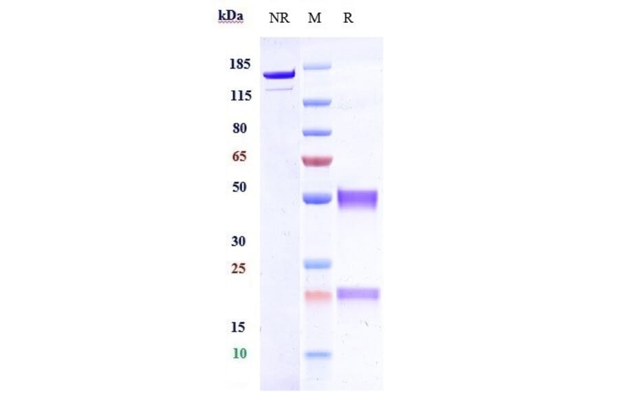 SDS-PAGE - Anti-Hemojuvelin Antibody [DISC-0974] - Low endotoxin, Azide free (A324053) - Antibodies.com