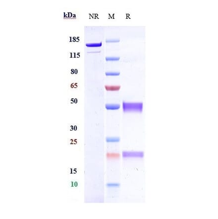 SDS-PAGE - Anti-Hemojuvelin Antibody [DISC-0974] - Low endotoxin, Azide free (A324053) - Antibodies.com