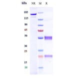 SDS-PAGE - Anti-Hemojuvelin Antibody [DISC-0974] - Low endotoxin, Azide free (A324053) - Antibodies.com