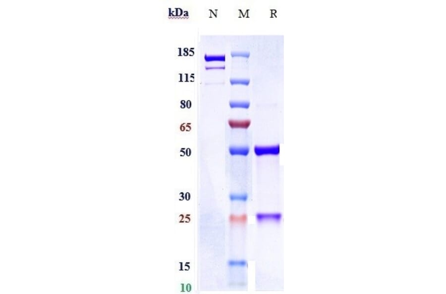 SDS-PAGE - Anti-Hepatitis B Virus Surface Antigen Antibody [OST 577] - Low endotoxin, Azide free (A324054) - Antibodies.com