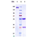 SDS-PAGE - Anti-Hepatitis B Virus Surface Antigen Antibody [OST 577] - Low endotoxin, Azide free (A324054) - Antibodies.com