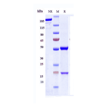 SDS-PAGE - Anti-Hepcidin Antibody [Research Grade Biosimilar] - Low endotoxin, Azide free (A324055) - Antibodies.com