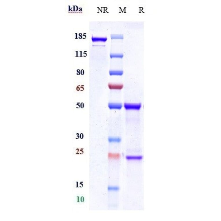 SDS-PAGE - Anti-HTRA1 Antibody [FHTR2163] - Low endotoxin, Azide free (A324063) - Antibodies.com