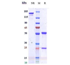 SDS-PAGE - Anti-IDO-2 Antibody [Research Grade Biosimilar] - Low endotoxin, Azide free (A324066) - Antibodies.com