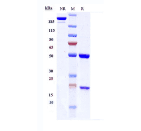 SDS-PAGE - Anti-IGF1 Receptor Antibody [Research Grade Biosimilar] - Low endotoxin, Azide free (A324067) - Antibodies.com