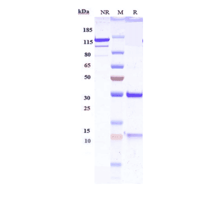 SDS-PAGE - Anti-IGF2 Antibody [DX-2647] - Low endotoxin, Azide free (A324068) - Antibodies.com