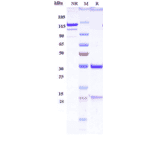 SDS-PAGE - Anti-IGF2 Antibody [DX-2647] - Low endotoxin, Azide free (A324068) - Antibodies.com