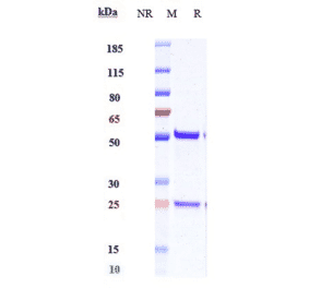 SDS-PAGE - Anti-IL-15 Antibody [DISC0280] - Low endotoxin, Azide free (A324079) - Antibodies.com