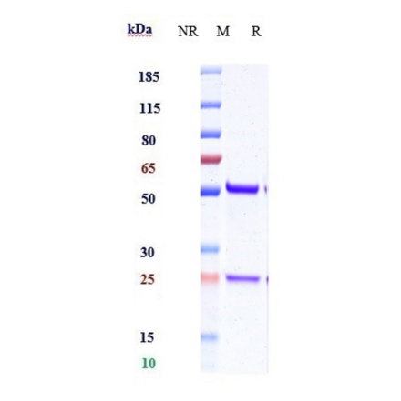 SDS-PAGE - Anti-IL-15 Antibody [DISC0280] - Low endotoxin, Azide free (A324079) - Antibodies.com