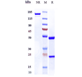 SDS-PAGE - Anti-IL-17A Antibody [Research Grade Biosimilar] - Low endotoxin, Azide free (A324080) - Antibodies.com