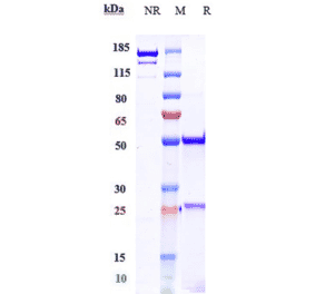 SDS-PAGE - Anti-IL-17A Antibody [CAT-2200] - Low endotoxin, Azide free (A324081) - Antibodies.com