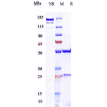 SDS-PAGE - Anti-IL-17A Antibody [CAT-2200] - Low endotoxin, Azide free (A324081) - Antibodies.com