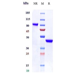SDS-PAGE - Anti-IL-17A Antibody [SY18-VHH-11] - Low endotoxin, Azide free (A324082) - Antibodies.com