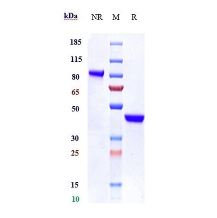 SDS-PAGE - Anti-IL-17A Antibody [SY18-VHH-11] - Low endotoxin, Azide free (A324082) - Antibodies.com