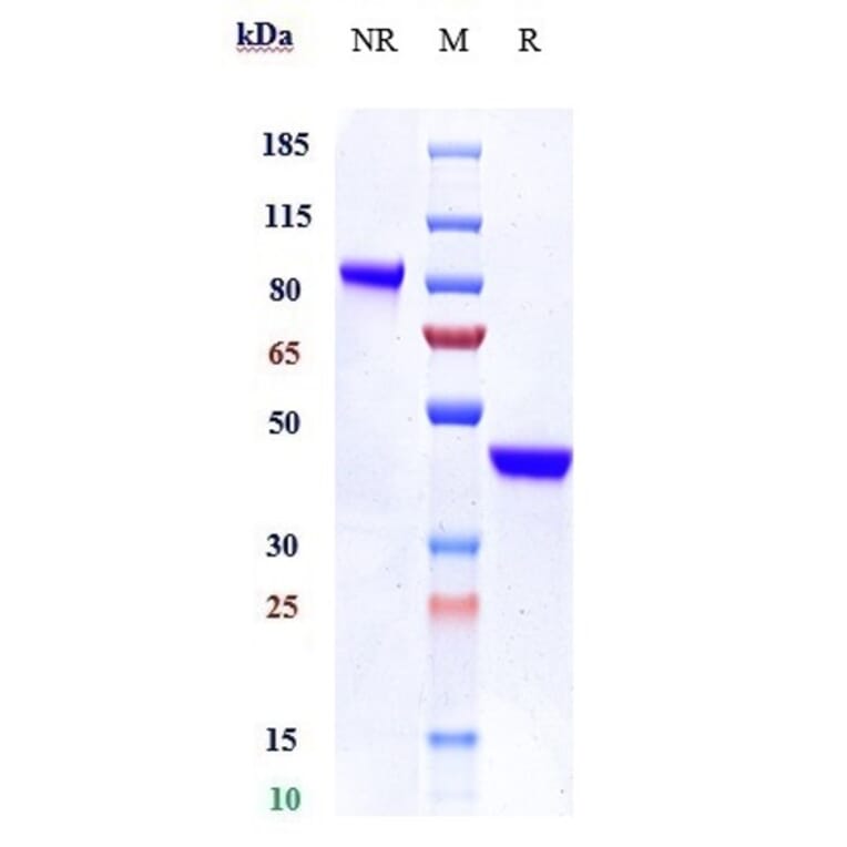 SDS-PAGE - Anti-IL-17A Antibody [SY18-VHH-11] - Low endotoxin, Azide free (A324082) - Antibodies.com