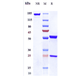 SDS-PAGE - Anti-IL-18 Antibody [GSK 1070806] - Low endotoxin, Azide free (A324084) - Antibodies.com