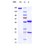 SDS-PAGE - Anti-IL-18 Antibody [GSK 1070806] - Low endotoxin, Azide free (A324084) - Antibodies.com