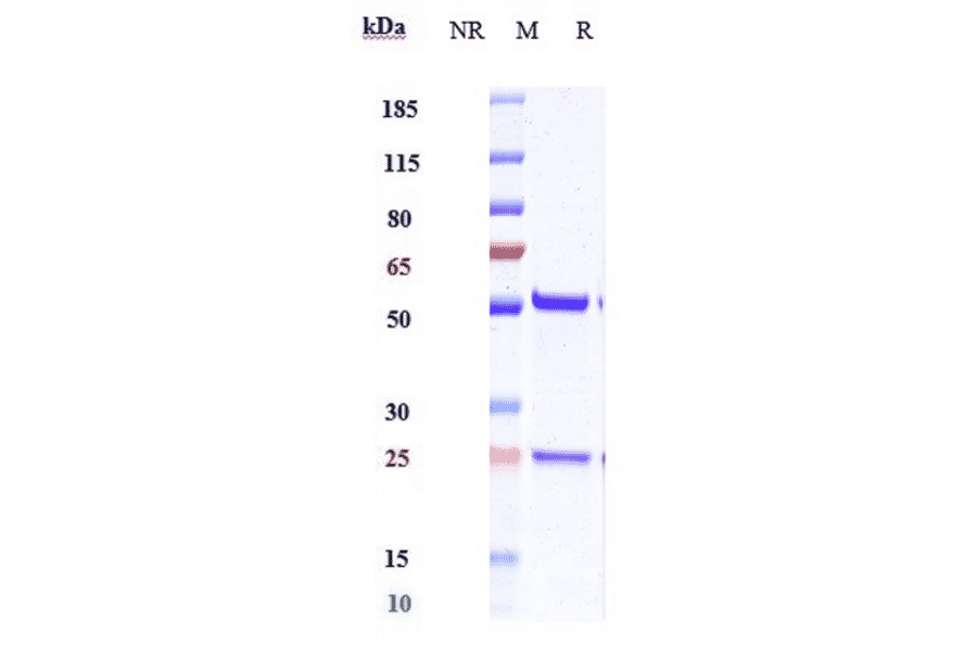 SDS-PAGE - Anti-IL-18 Antibody [ABT-325] - Low endotoxin, Azide free (A324085) - Antibodies.com