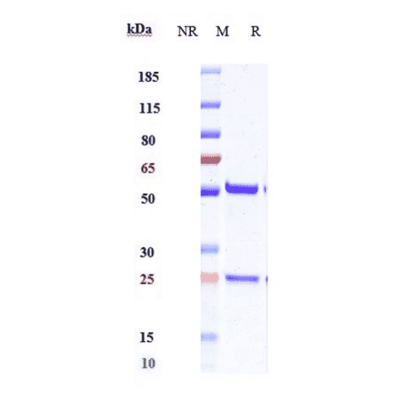 SDS-PAGE - Anti-IL-18 Antibody [ABT-325] - Low endotoxin, Azide free (A324085) - Antibodies.com