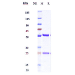 SDS-PAGE - Anti-IL-18 Antibody [ABT-325] - Low endotoxin, Azide free (A324085) - Antibodies.com
