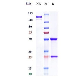 SDS-PAGE - Anti-IL-20R1 Antibody [Research Grade Biosimilar] - Low endotoxin, Azide free (A324087) - Antibodies.com