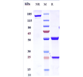 SDS-PAGE - Anti-IL-21 Antibody [Research Grade Biosimilar] - Low endotoxin, Azide free (A324088) - Antibodies.com