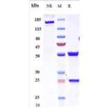 SDS-PAGE - Anti-IL-21 Antibody [Research Grade Biosimilar] - Low endotoxin, Azide free (A324088) - Antibodies.com