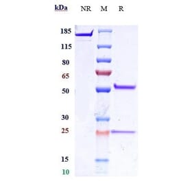 SDS-PAGE - Anti-IL-25 Antibody [Research Grade Biosimilar] - Low endotoxin, Azide free (A324091) - Antibodies.com