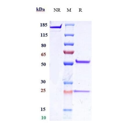 SDS-PAGE - Anti-IL-25 Antibody [Research Grade Biosimilar] - Low endotoxin, Azide free (A324091) - Antibodies.com