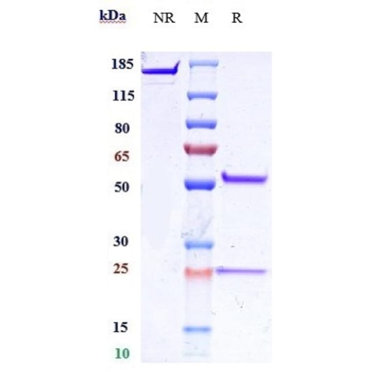 SDS-PAGE - Anti-IL-25 Antibody [Research Grade Biosimilar] - Low endotoxin, Azide free (A324091) - Antibodies.com