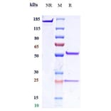 SDS-PAGE - Anti-IL-25 Antibody [Research Grade Biosimilar] - Low endotoxin, Azide free (A324091) - Antibodies.com