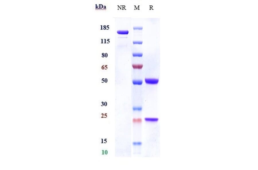 SDS-PAGE - Anti-IL-3RB Antibody [CSL311] - Low endotoxin, Azide free (A324093) - Antibodies.com