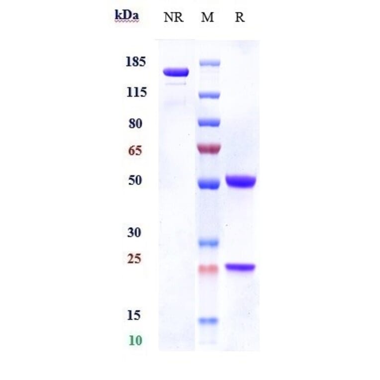SDS-PAGE - Anti-IL-3RB Antibody [CSL311] - Low endotoxin, Azide free (A324093) - Antibodies.com