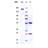 SDS-PAGE - Anti-IL-3RB Antibody [CSL311] - Low endotoxin, Azide free (A324093) - Antibodies.com