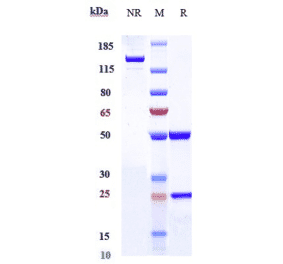 SDS-PAGE - Anti-IL-5 Antibody [Research Grade Biosimilar] - Low endotoxin, Azide free (A324095) - Antibodies.com