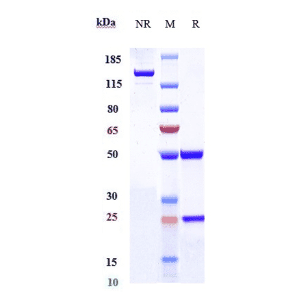 SDS-PAGE - Anti-IL-5 Antibody [Research Grade Biosimilar] - Low endotoxin, Azide free (A324095) - Antibodies.com