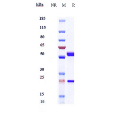 SDS-PAGE - Anti-IL-6 Antibody [Research Grade Biosimilar] - Low endotoxin, Azide free (A324096) - Antibodies.com