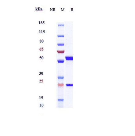 SDS-PAGE - Anti-IL-6 Antibody [Research Grade Biosimilar] - Low endotoxin, Azide free (A324096) - Antibodies.com