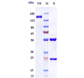SDS-PAGE - Anti-IL-6 Antibody [Research Grade Biosimilar] - Low endotoxin, Azide free (A324099) - Antibodies.com