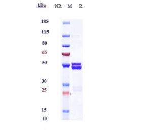 SDS-PAGE - Anti-IL-6 Antibody [MEDI 5117] - Low endotoxin, Azide free (A324100) - Antibodies.com