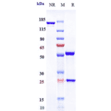SDS-PAGE - Anti-IL-6R Antibody [APX007] - Low endotoxin, Azide free (A324101) - Antibodies.com