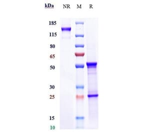 SDS-PAGE - Anti-IL-8 Antibody [Research Grade Biosimilar] - Low endotoxin, Azide free (A324103) - Antibodies.com