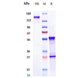 SDS-PAGE - Anti-IL-8 Antibody [Research Grade Biosimilar] - Low endotoxin, Azide free (A324103) - Antibodies.com