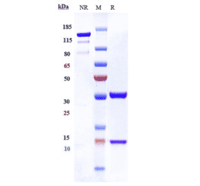 SDS-PAGE - Anti-IL-8 Antibody [ABX-IL8] - Low endotoxin, Azide free (A324104) - Antibodies.com